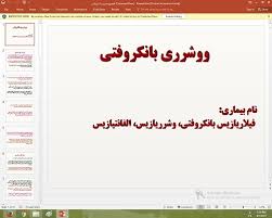 پاورپوینت درمورد ووشرری بانکروفتی
